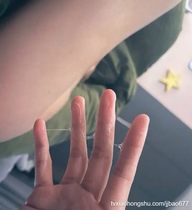 每天都湿湿的可怎么办啊