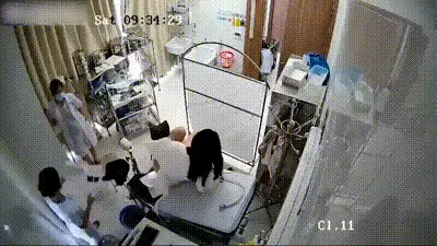 医院人流手术，麻醉的妹子做人流手术 动图预览